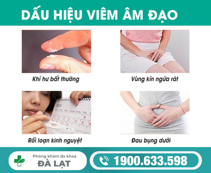 Hình ảnh minh họa